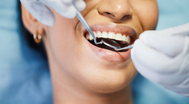 Best Emergency Tooth Extraction in Barboursville, WV